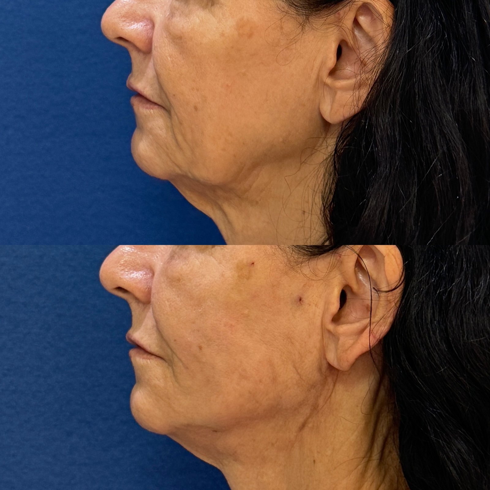 4DA296F8-49CC-4CE8-AE56-A3C05DCCCFF3